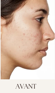 Argile ghassoul marocain pour cheveux et peau